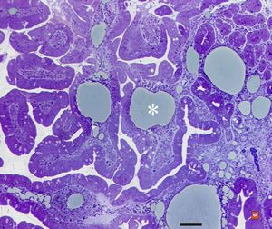 cured Whipple disease (semithin section)